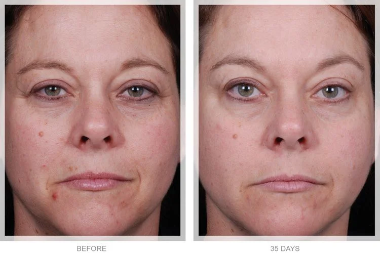 a woman's face before and after