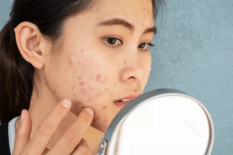 a woman looking at her face