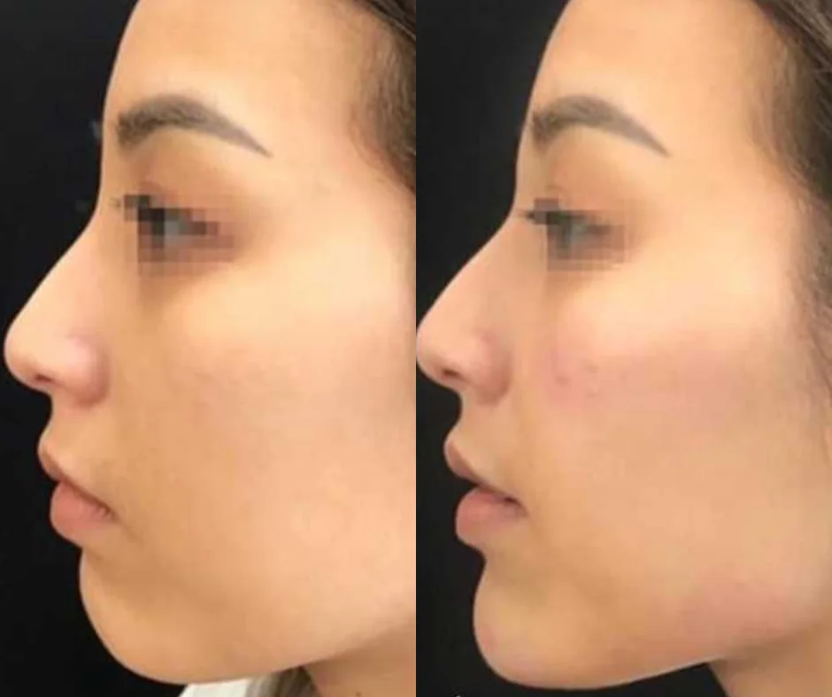 a side view of a woman's face