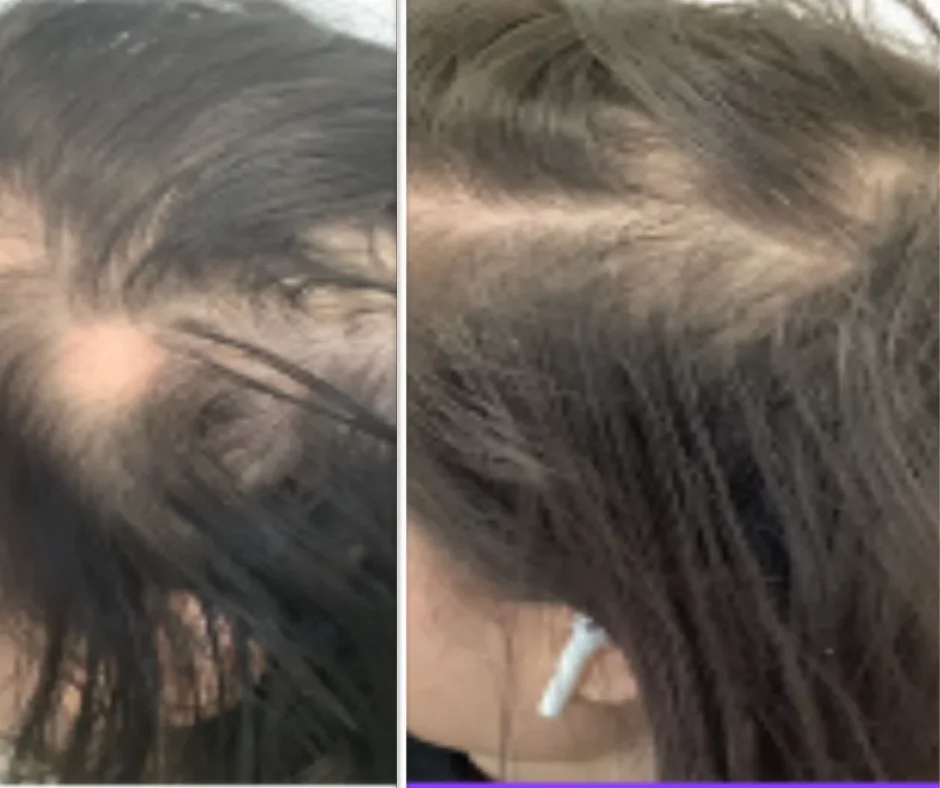 a woman's head with a white object in her hair
