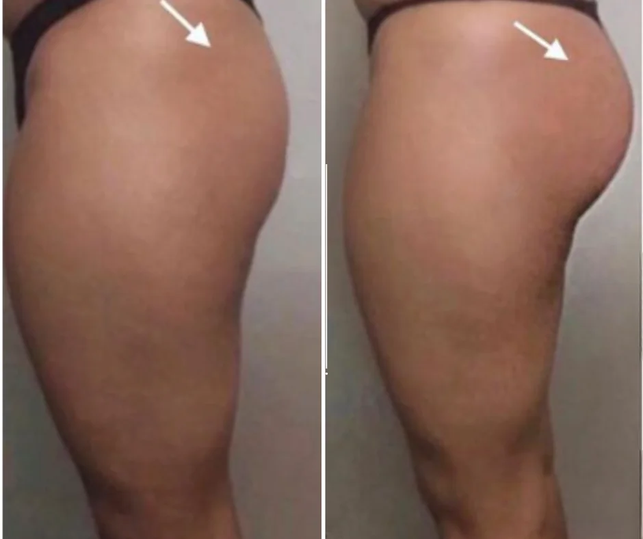 a woman's buttocks with arrows