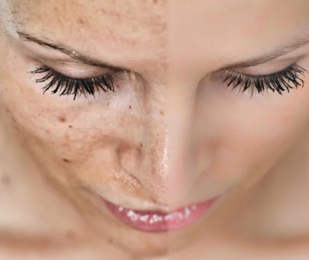 a woman with freckles and eyelashes