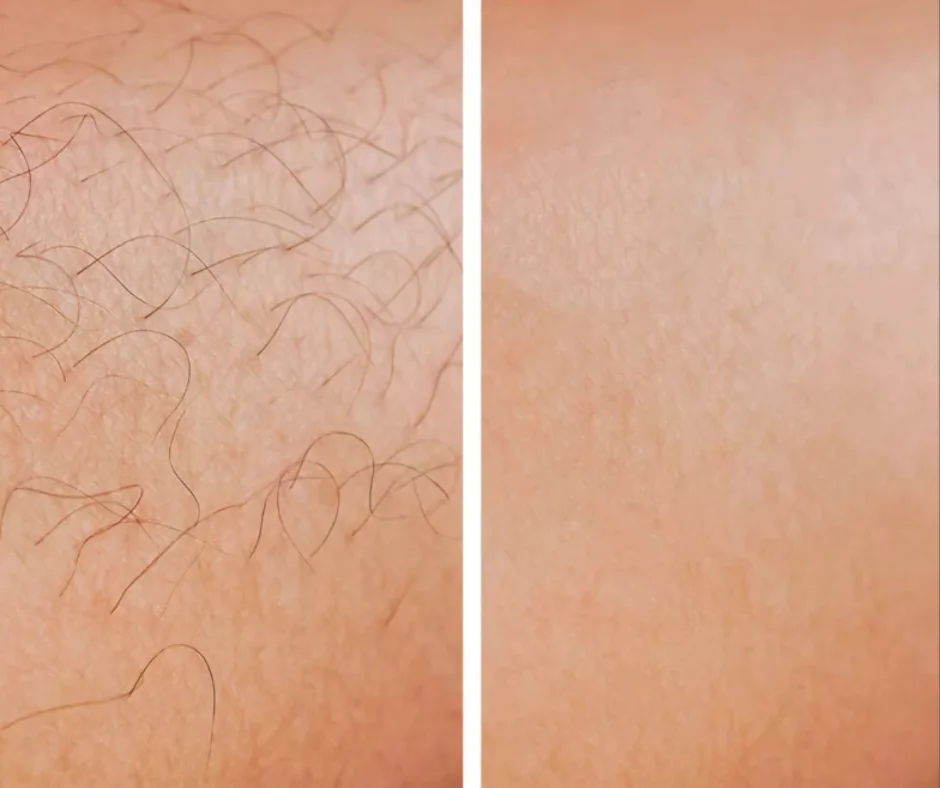 close up of a person's hairy skin