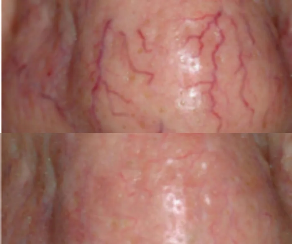 close up of red veins