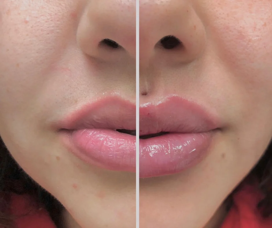a close up of a woman's lips