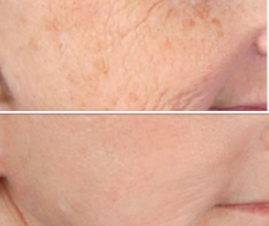 a close-up of a person's face