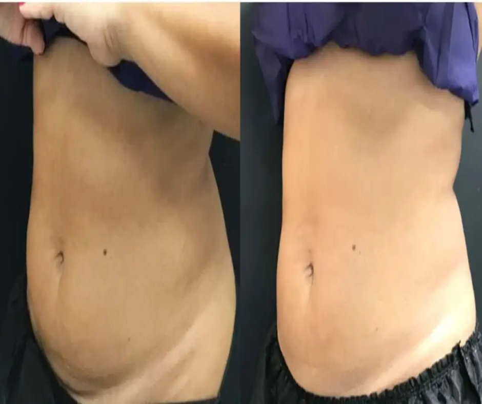 a collage of a woman's belly
