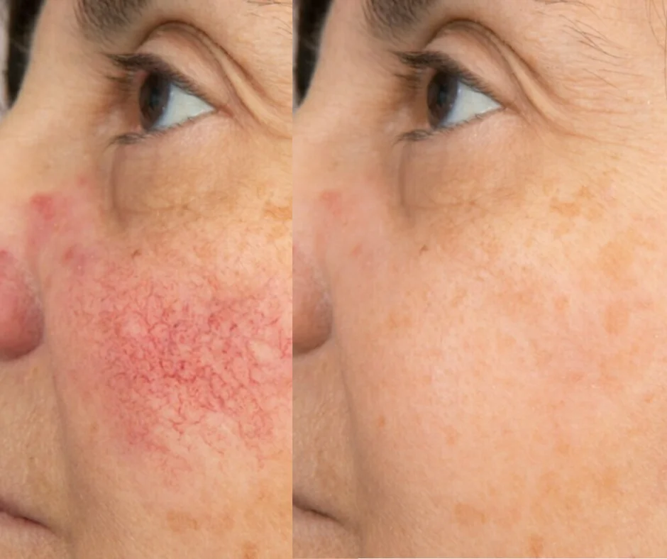 a close up of a person's face