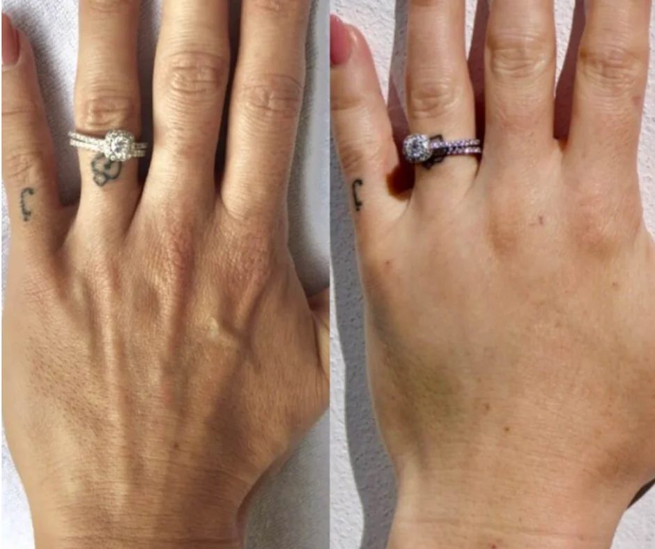 a comparison of a hand with a ring on it