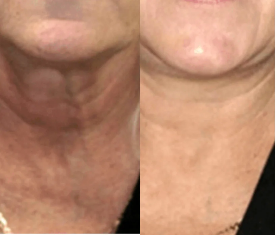 a collage of a woman's neck