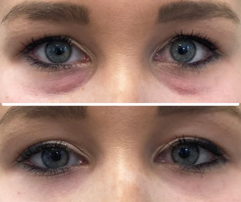 a close up of a woman's eyes