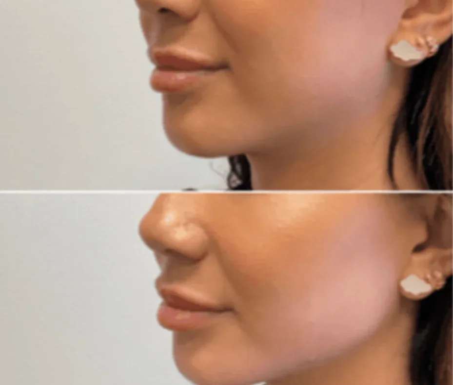 a woman's face before and after