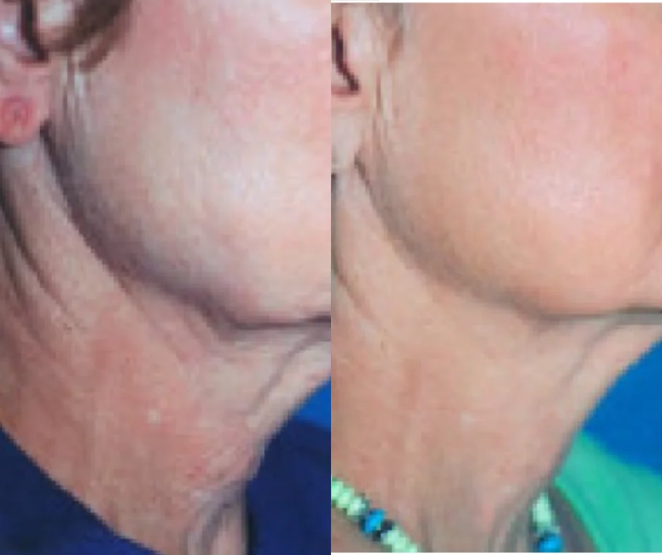 a close-up of a woman's neck