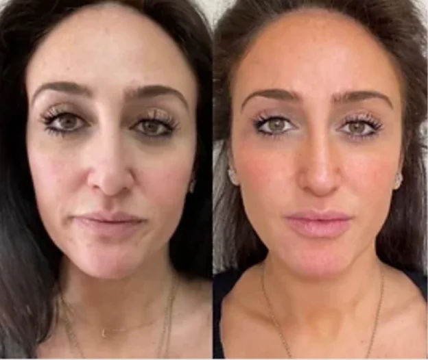 a comparison of a woman's face