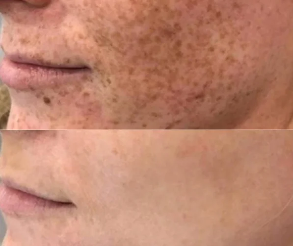 a close up of a person's face